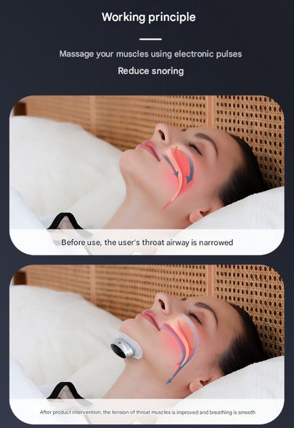 Black Smart Anti-Snoring Device - Rechargeable Pulse Throat Stimulator for Quieter Sleep Tristar Online