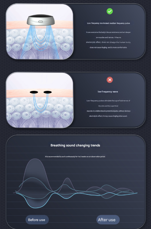 Black Smart Anti-Snoring Device - Rechargeable Pulse Throat Stimulator for Quieter Sleep Tristar Online