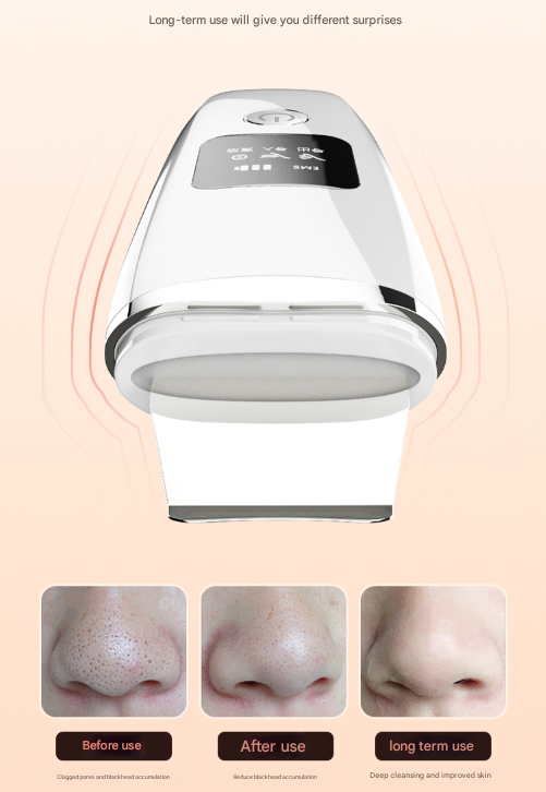 White Professional 4-in-1 Ultrasonic Skin Scrubber - Deep Pore Cleanser, Blackhead Remover & EMS Facial Lifting Tool Tristar Online