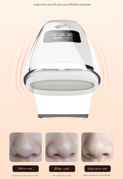 White Professional 4-in-1 Ultrasonic Skin Scrubber - Deep Pore Cleanser, Blackhead Remover & EMS Facial Lifting Tool Tristar Online