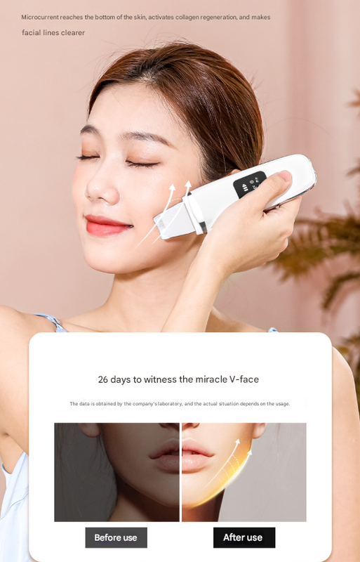 White Professional 4-in-1 Ultrasonic Skin Scrubber - Deep Pore Cleanser, Blackhead Remover & EMS Facial Lifting Tool Tristar Online