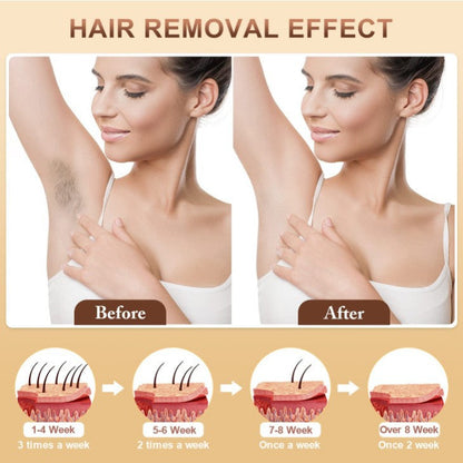 IPL Hair Removal Device - 3-in-1 Permanent Hair Reduction, Skin Rejuvenation & Acne Control(white) Tristar Online