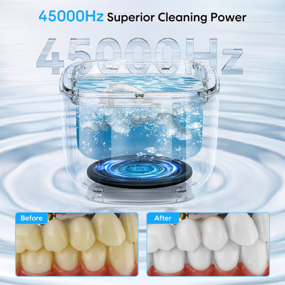 Professional Ultrasonic Cleaner with UV Light - 45000Hz for Dentures, Retainers, Jewelry & More(white) Tristar Online